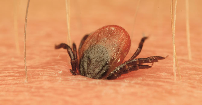 neuroborelioza
